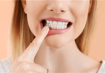 Gengive arrossate: cause e rimedi di un fastidio frequente